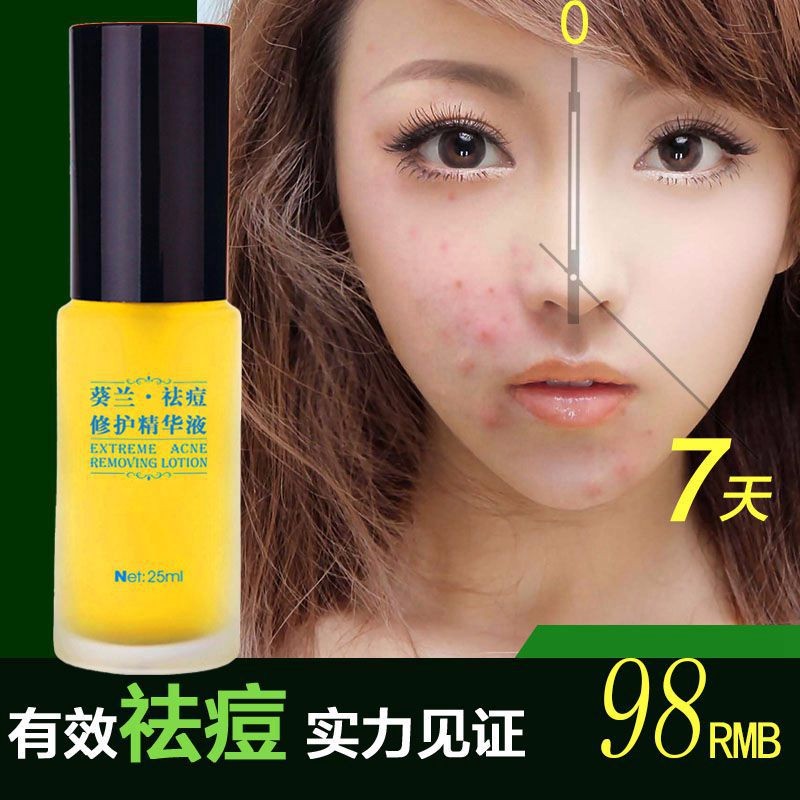 葵兰祛痘修护精华液25ml